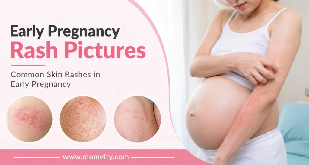 Early pregnancy rash pictures
