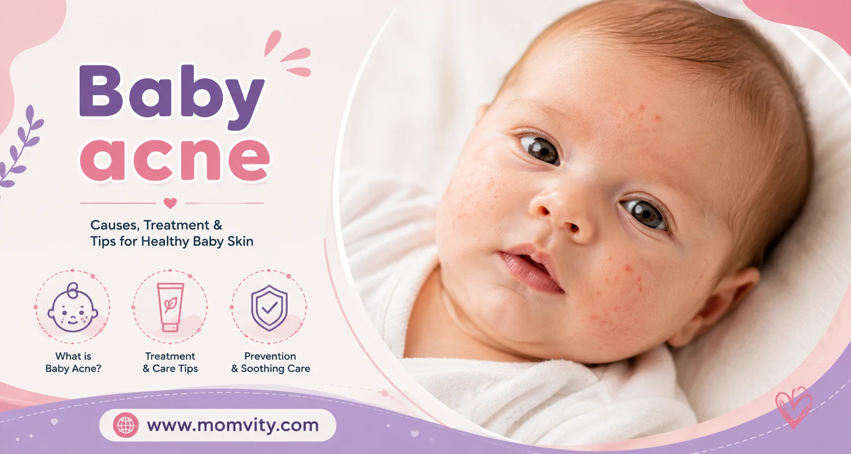 Baby acne