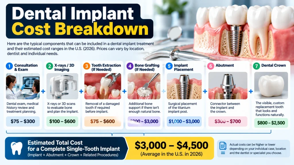 Dental Implant Cost Breakdown